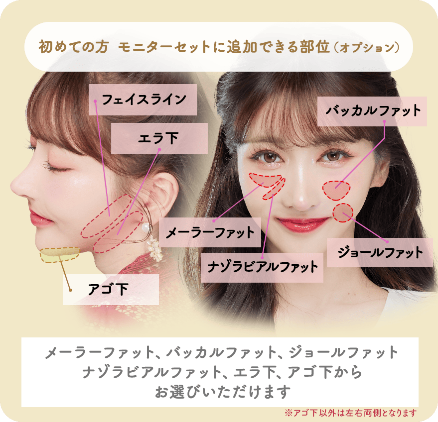顎下の脂肪吸引も対応可能