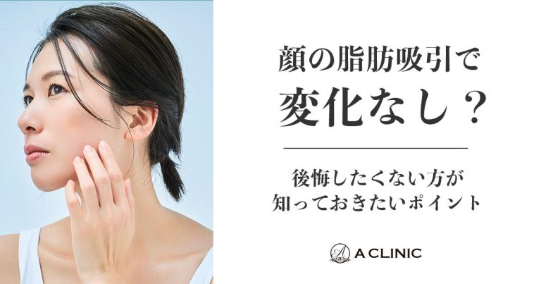 【顔の脂肪吸引で変化なし？】後悔したくない方が知っておきたいポイント