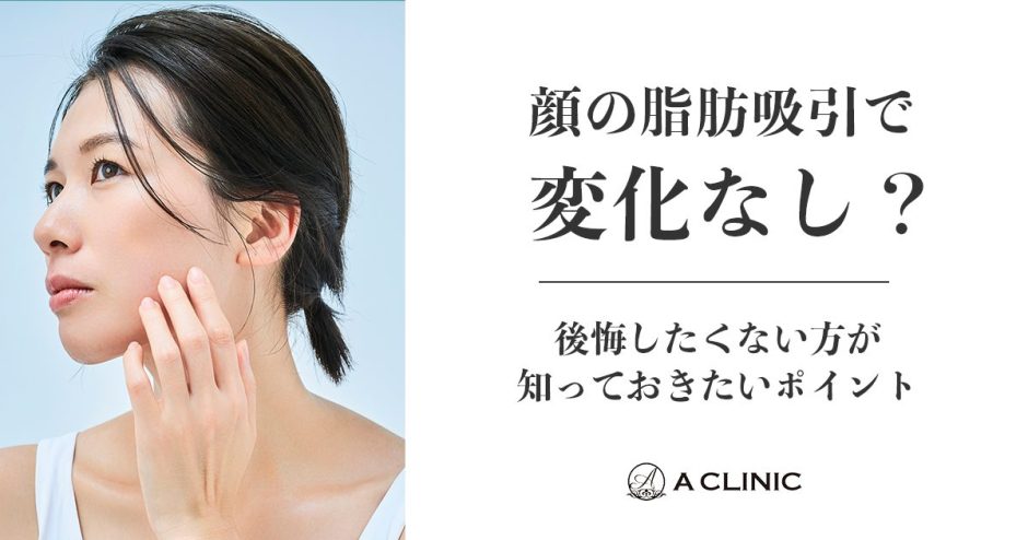 【顔の脂肪吸引で変化なし？】後悔したくない方が知っておきたいポイント