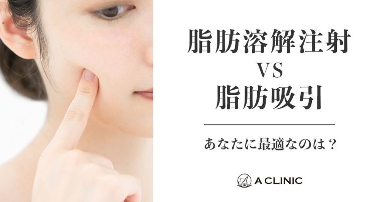 【二重顎を解消したい】脂肪溶解注射 vs 脂肪吸引、あなたに最適なのは？