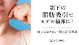 【二重あご解消】顎下の脂肪吸引でモデル輪郭に！知っておきたい“個人差”も解説
