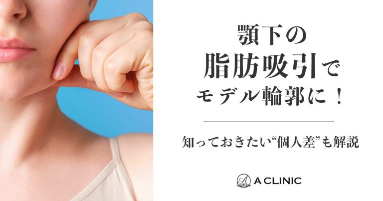 【二重あご解消】顎下の脂肪吸引でモデル輪郭に！知っておきたい“個人差”も解説