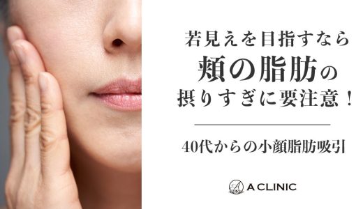 【40代からの小顔脂肪吸引】若見えを目指すなら、頬の脂肪の取りすぎに要注意！