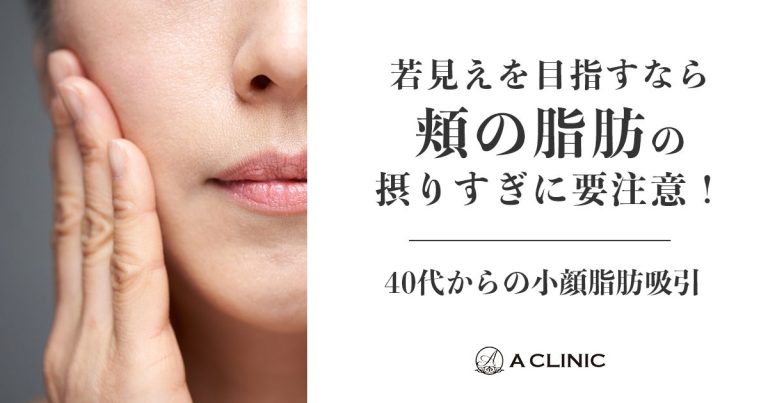 【40代からの小顔脂肪吸引】若見えを目指すなら、頬の脂肪の取りすぎに要注意！