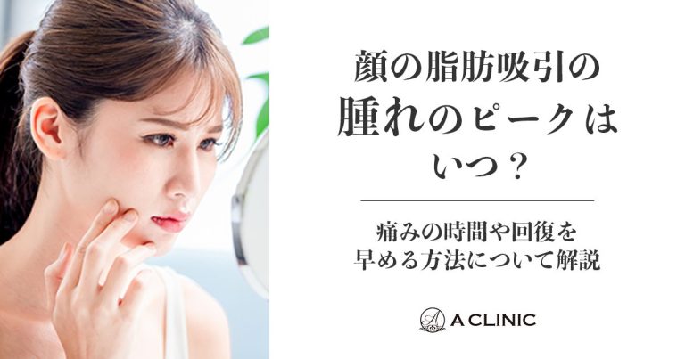 顔の脂肪吸引の腫れのピークはいつ？痛みの期間や回復を早める方法について解説