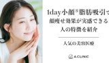 人気の美容医療『1day小顔®脂肪吸引』で「顔痩せ効果が実感できる人」の特徴を紹介