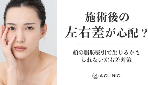 施術後の「左右差」が心配？顔の脂肪吸引で生じるかもしれない左右差対策