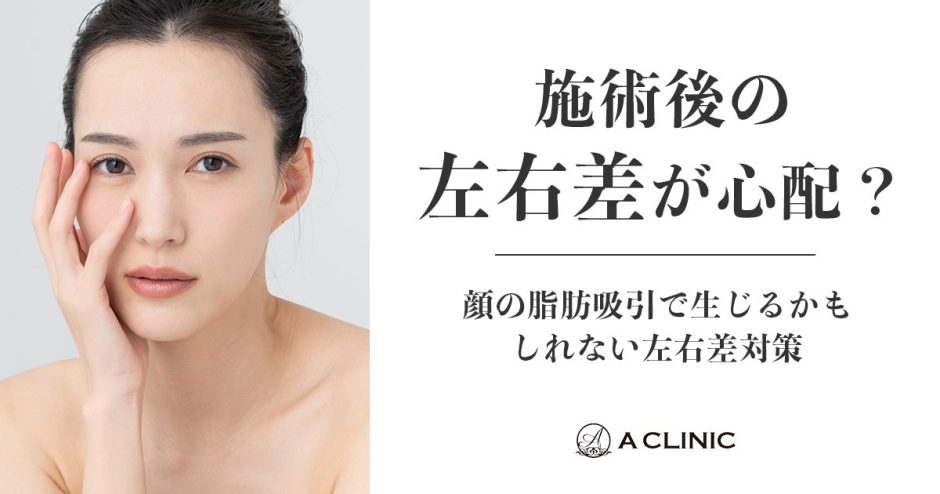 施術後の「左右差」が心配？顔の脂肪吸引で生じるかもしれない左右差対策