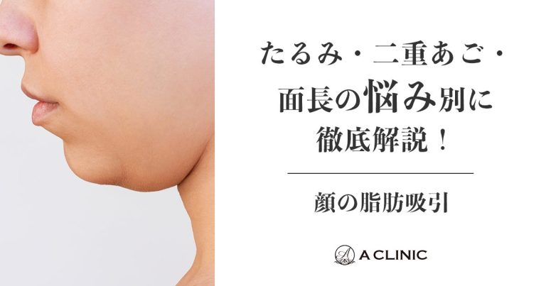 【顔の脂肪吸引】たるみ・二重あご・面長の悩み別に徹底解説！