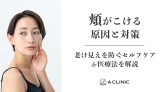 頬がこける原因と対策｜老け見えを防ぐセルフケア＆医療法を解説