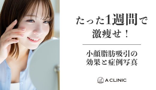 たった1週間で顔痩せ！小顔脂肪吸引の効果と症例写真
