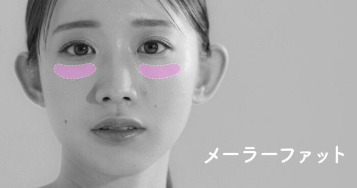 メーラーファットとは？