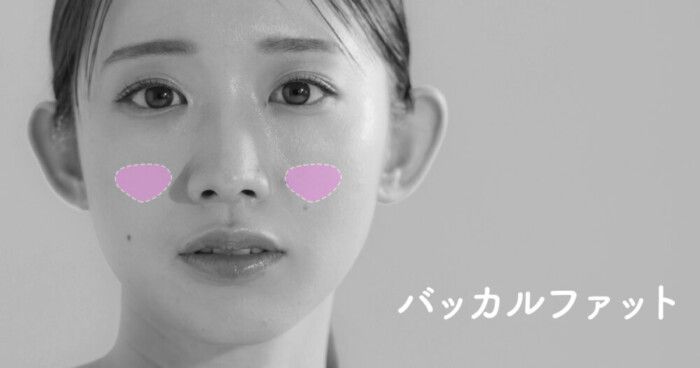 バッカルファットとは？