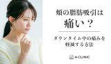 頬の脂肪吸引は痛い？ダウンタイム中の痛みを軽減する方法