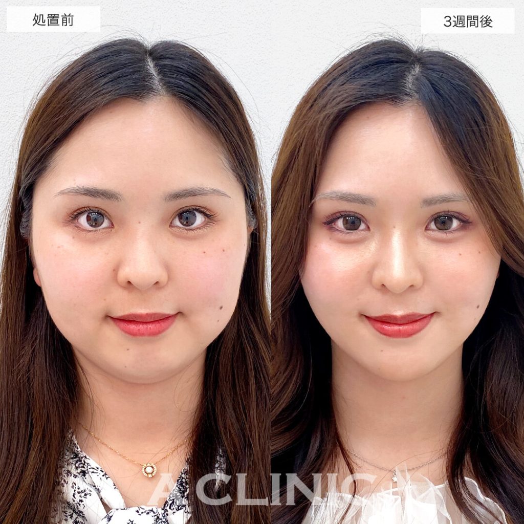2．症例写真がきれいな先生