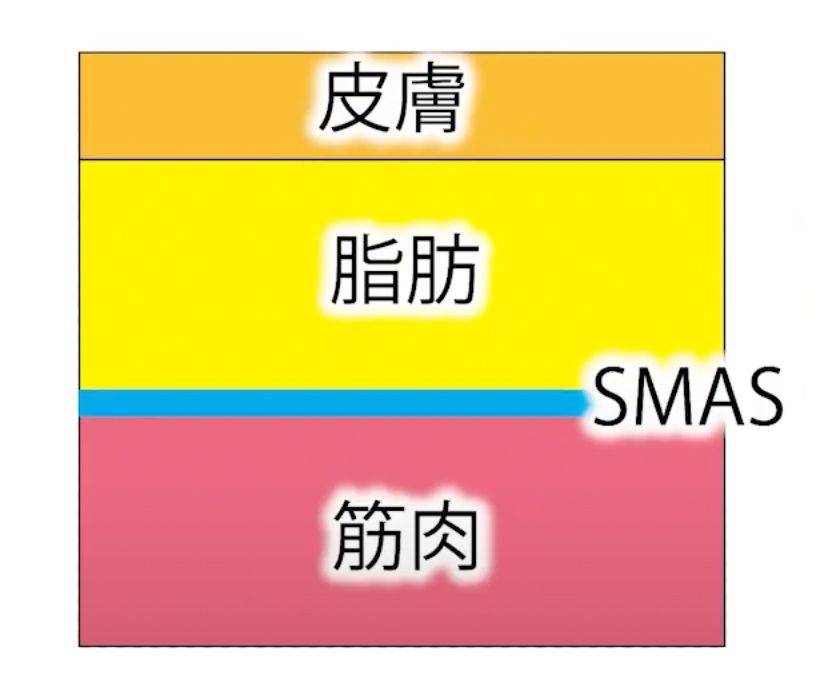HIFU(ハイフ)で頬コケしてしまうのはなぜ？
