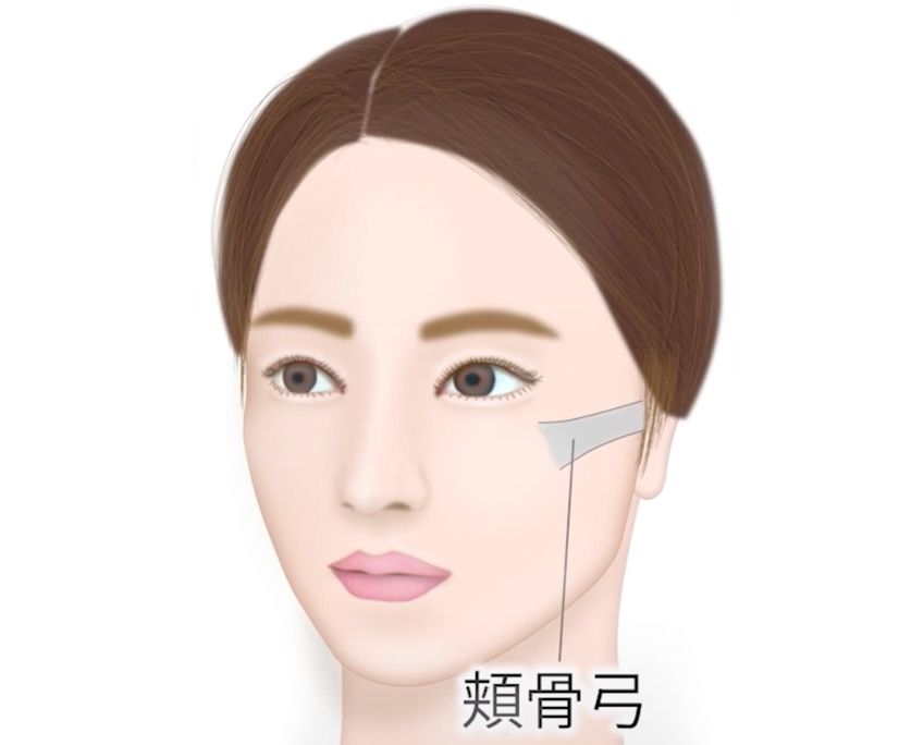 ハイフによって頬がコケるリスクについて