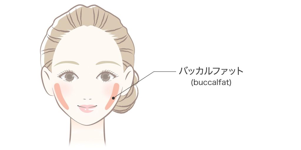 バッカルファット