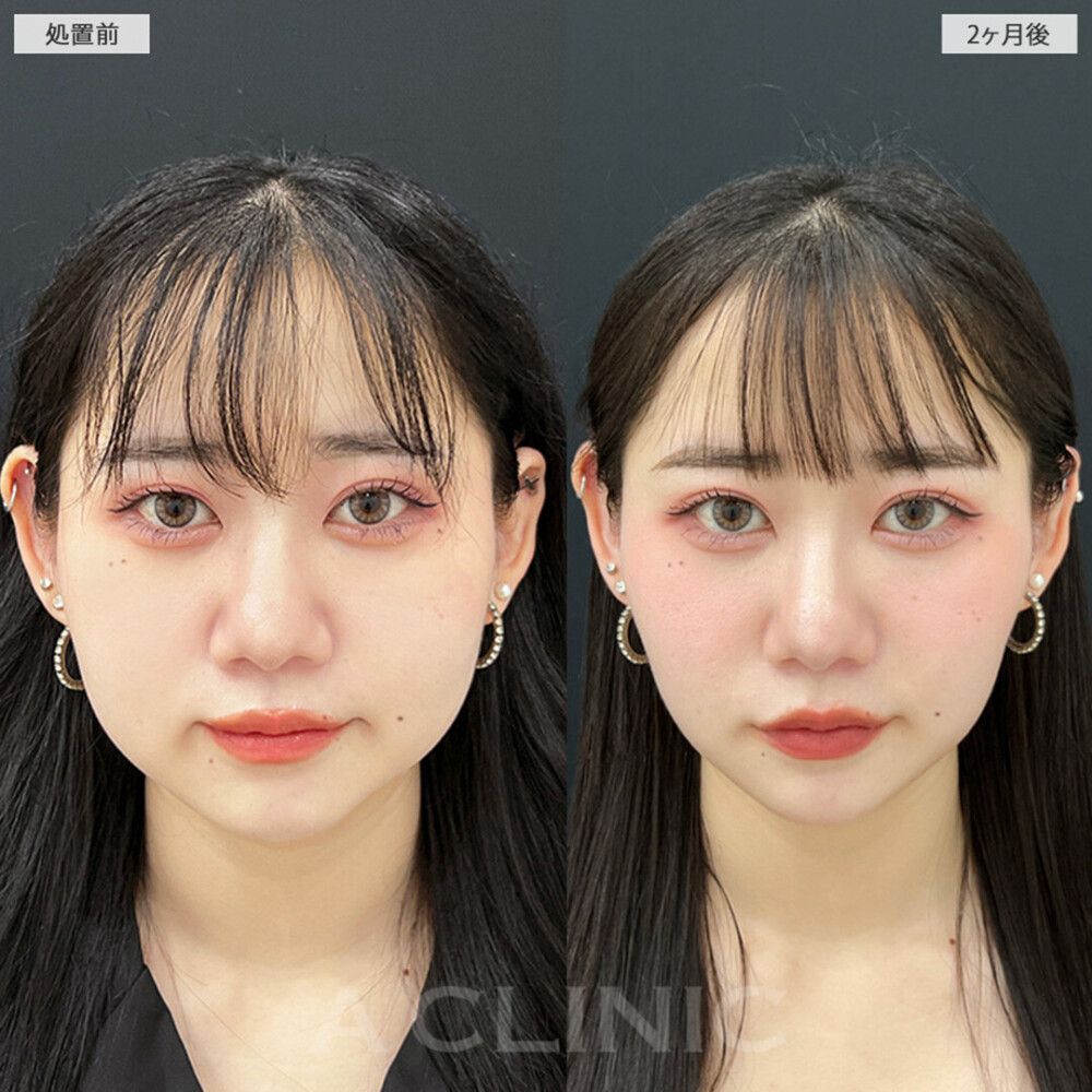 症例写真を参考にする