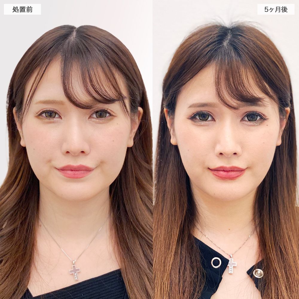 症例写真②