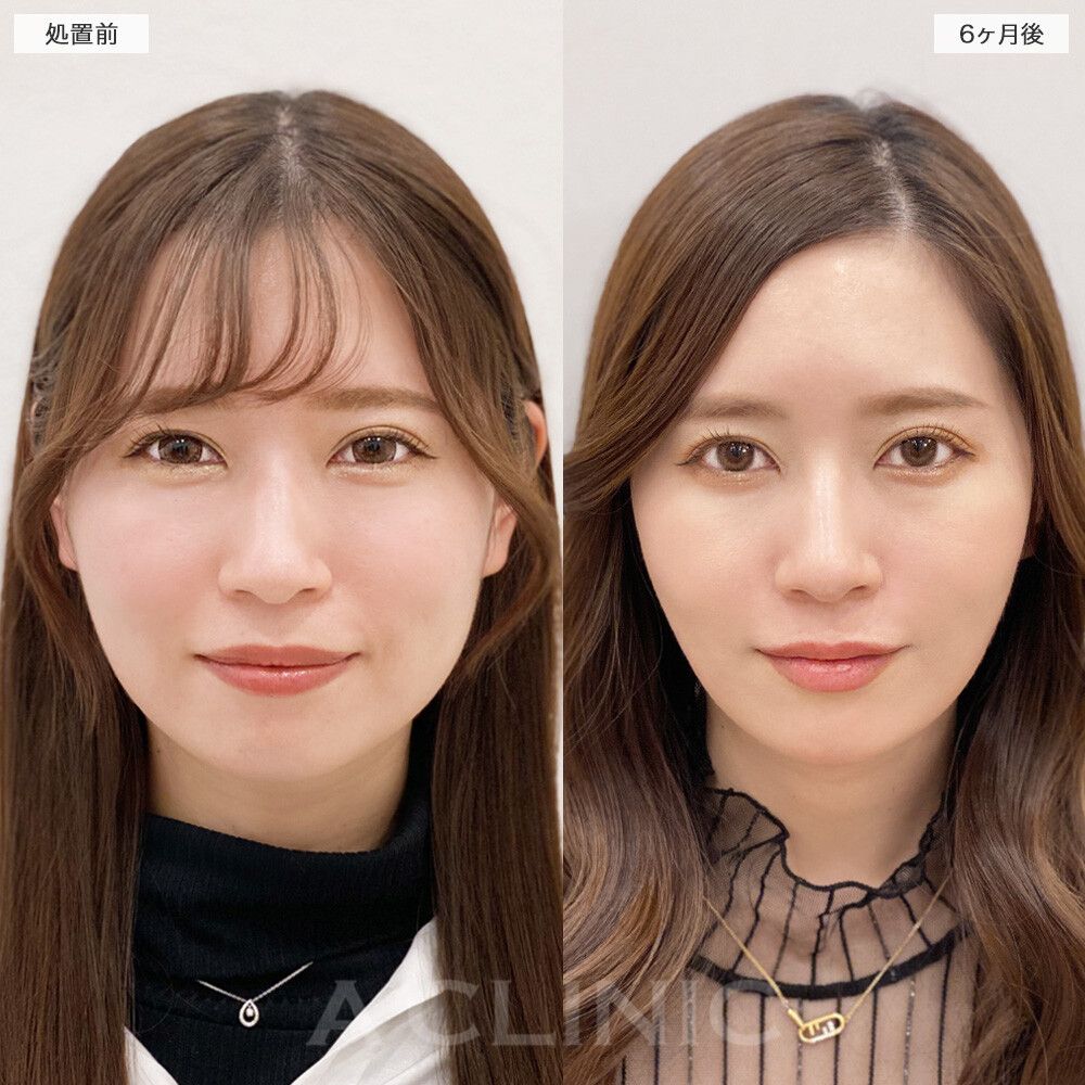 症例写真①