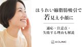 【ほうれい線脂肪吸引で若見え小顔に】適応・注意点・失敗する理由も解説