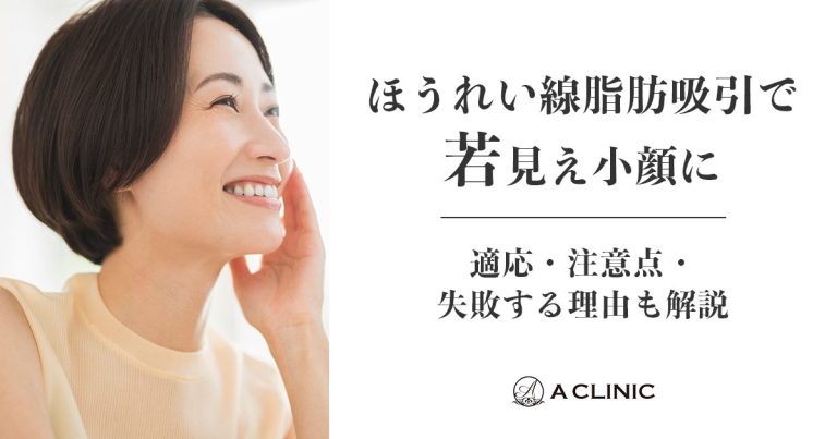 【ほうれい線脂肪吸引で若見え小顔に】適応・注意点・失敗する理由も解説
