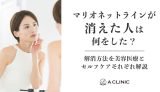 マリオネットラインが「消えた人」は何をした？解消方法を美容医療とセルフケアそれぞれ解説