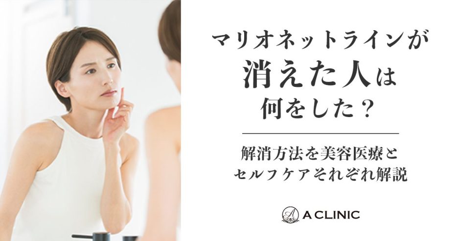 マリオネットラインが「消えた人」は何をした？解消方法を美容医療とセルフケアそれぞれ解説
