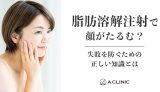 脂肪溶解注射で顔がたるむ？失敗を防ぐための正しい知識とは