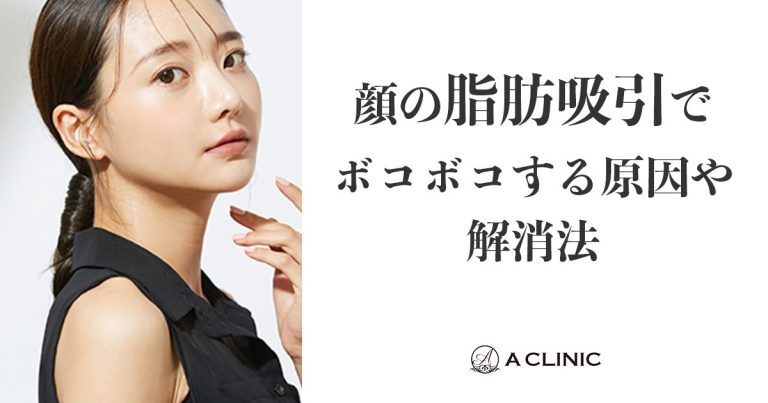 顔の脂肪吸引でボコボコする原因や解消法