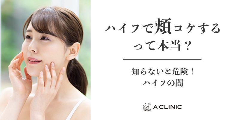 【ハイフの闇】知らないと危険！ハイフで頬コケするって本当？