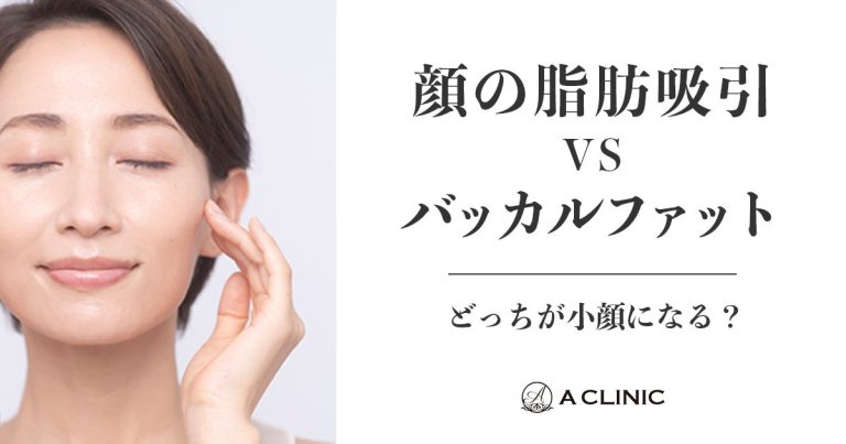 【顔の脂肪吸引vsバッカルファット】どっちが小顔になる？ それぞれの特徴や違いについて詳しく解説！
