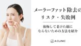 メーラーファット除去のリスク・失敗例｜後悔して老けた顔にならないための方法を紹介