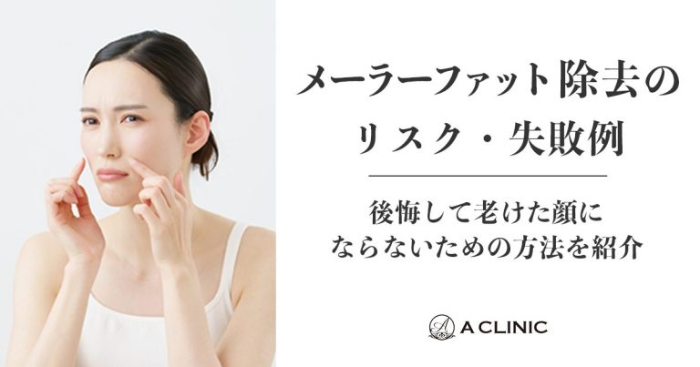 メーラーファット除去のリスク・失敗例｜後悔して老けた顔にならないための方法を紹介