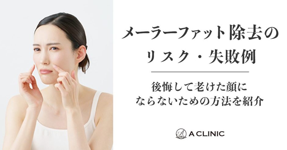 メーラーファット除去のリスク・失敗例｜後悔して老けた顔にならないための方法を紹介