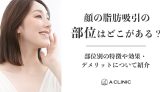 顔の脂肪吸引の部位はどこがある？部位別の特徴や効果・デメリットについて紹介