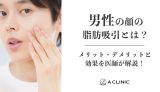 男性の顔の脂肪吸引とは？メリット・デメリットと効果を医師が解説！
