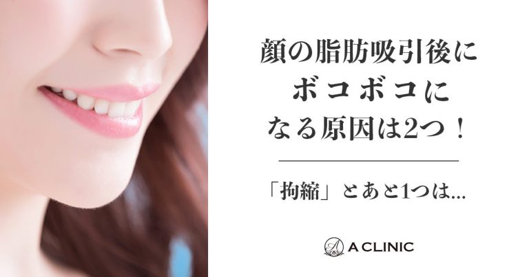 顔の脂肪吸引後にボコボコになる原因は２つ！「拘縮」とあと１つは…