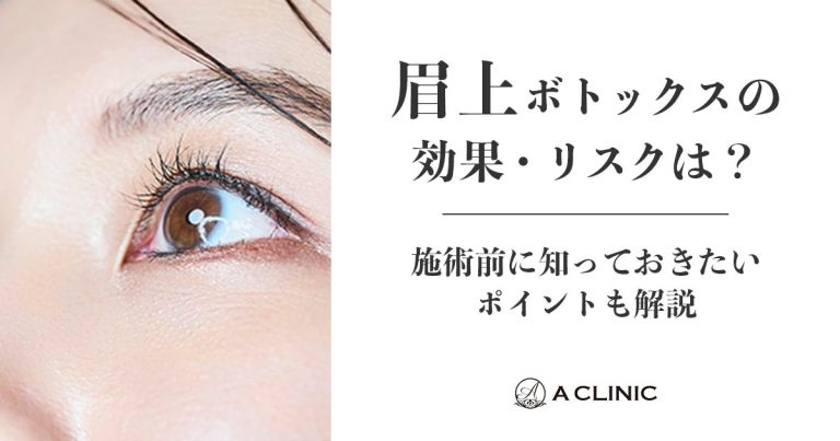 眉上ボトックスの効果・リスクは？施術前に知っておきたいポイントも解説