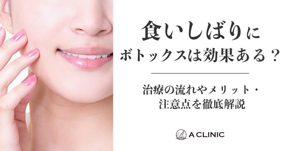 食いしばりにボトックスは効果ある？治療の流れやメリット・注意点を徹底解説