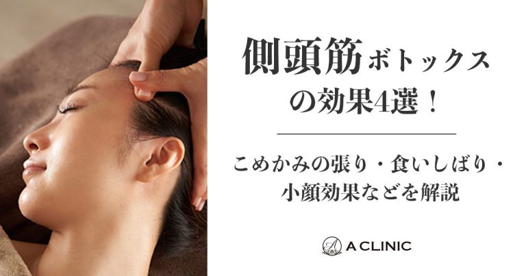 側頭筋ボトックスの効果4選！こめかみの張り・食いしばり・小顔効果などを解説
