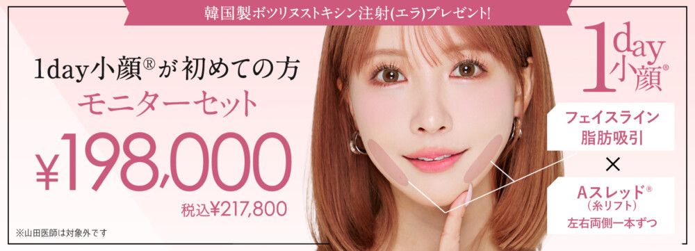 1day小顔®脂肪吸引で叶える、理想のフェイスライン