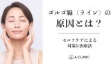 ゴルゴ線（ゴルゴライン）の原因とは？セルフケアによる対策&治療法
