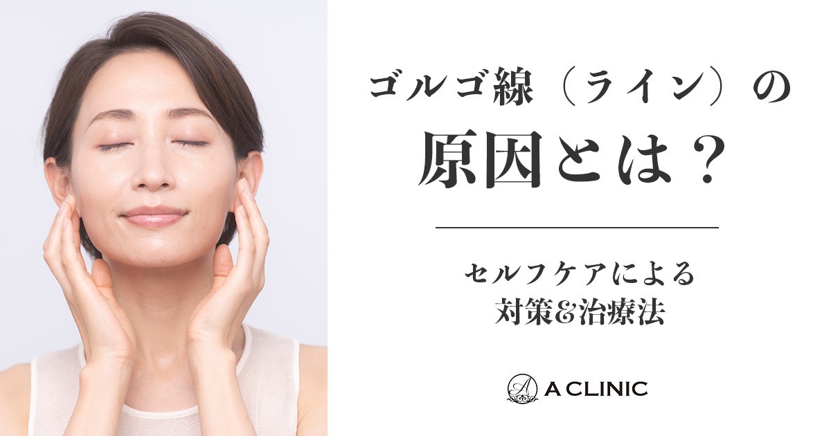 ゴルゴ線（ゴルゴライン）の原因とは？セルフケアによる対策&治療法