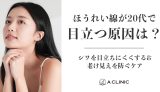 ほうれい線が20代で目立つ原因は?シワを目立ちにくくする&老け見えを防ぐケア