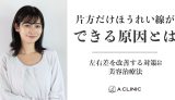 片方だけほうれい線ができる原因とは？左右差を改善する対策&美容治療法