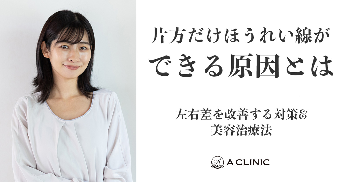 片方だけほうれい線ができる原因とは？左右差を改善する対策&美容治療法
