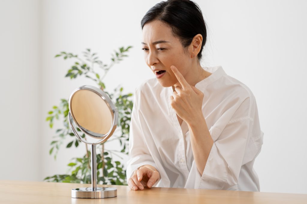 片方にできたほうれい線の美容医療