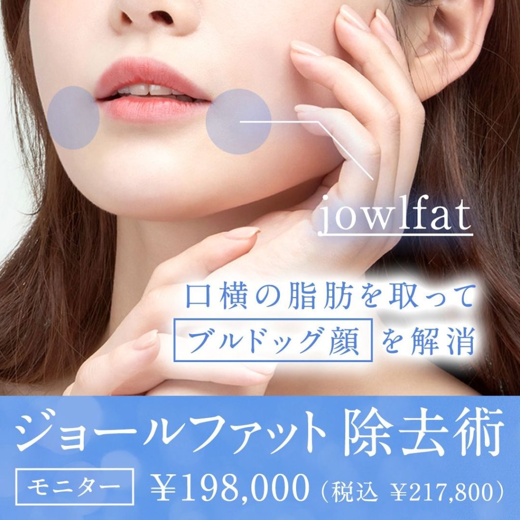 ジョールファット除去術